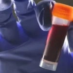 گروه خونی B و دیابت نوع ۲؛ آیا این گروه خونی خطر بیشتری دارد؟