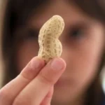 درمان آلرژی غذایی با میکروبیوم روده؛ روش جدیدی برای کاهش حساسیت به بادام‌زمینی
